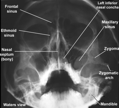 face2atlas.gif (114264 bytes)