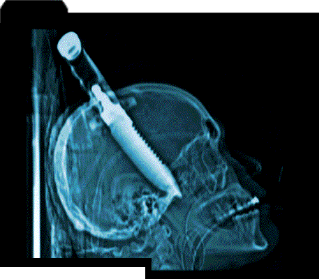 knife_head1.gif (39974 bytes)