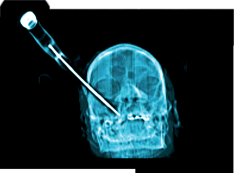 knife_head2.gif (22195 bytes)